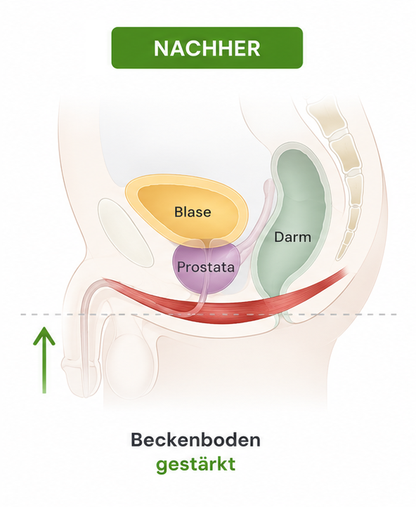 Nach Behandlung Beckenboden Männer