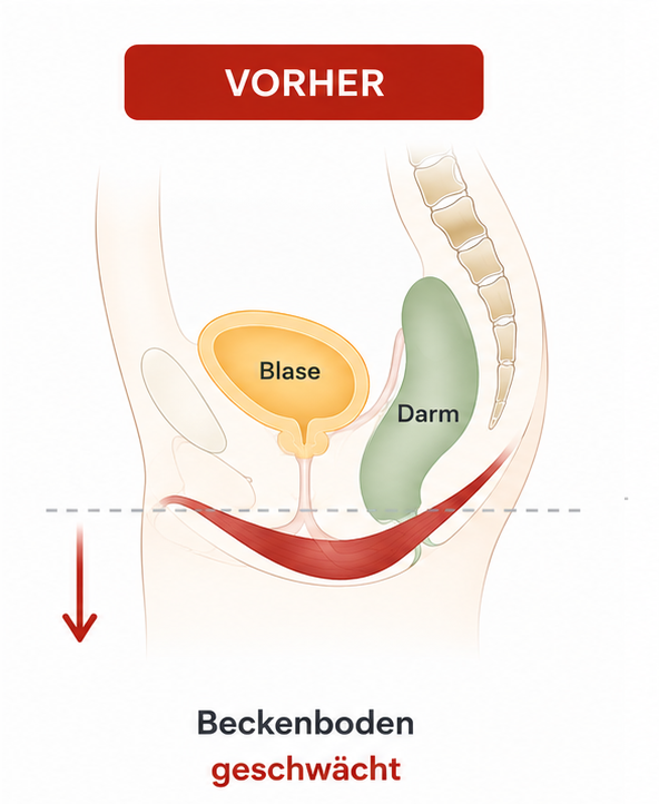 Vor der Beckenbodenbehandlung Frau 